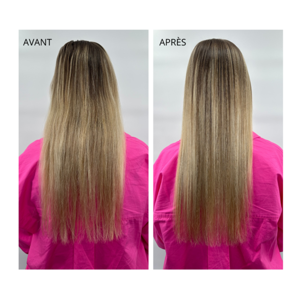 Hair Plasm – Image 2